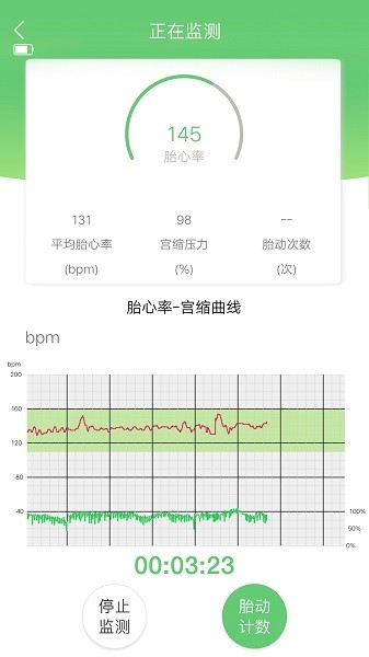 喜芽胎心监护仪app截图3