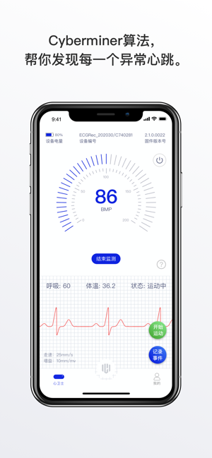 心卫士心脏检测截图3