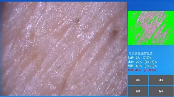 mrkv头皮检测仪截图2