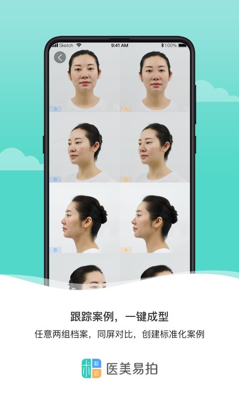 医美易拍最新版截图1