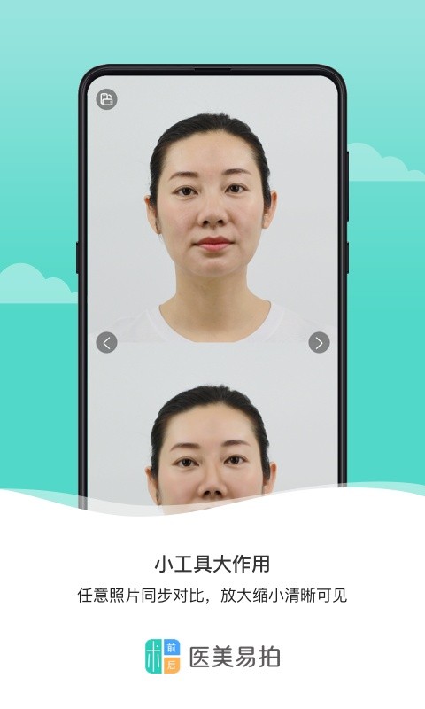 医美易拍最新版截图3