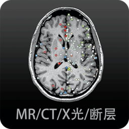 影像解剖图谱软件