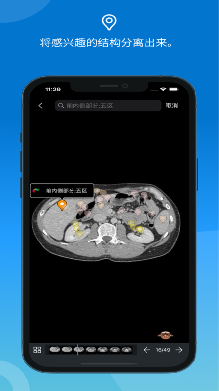 e-anatomy软件截图1