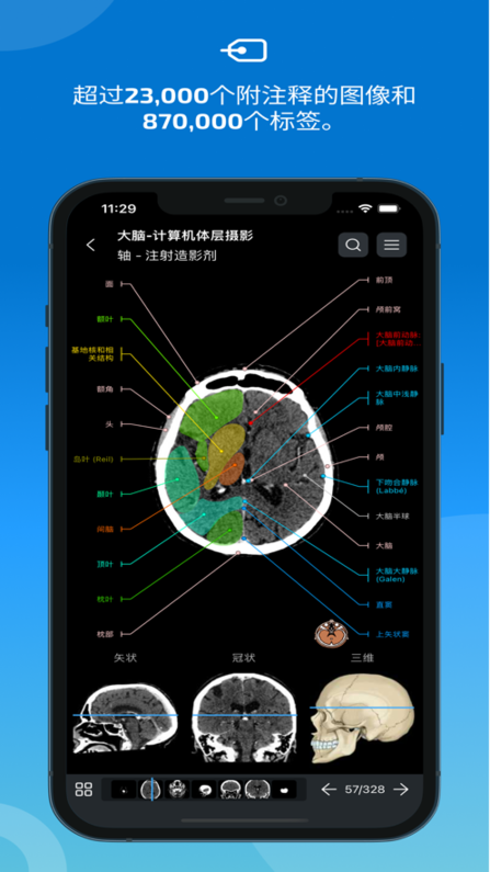 e-anatomy软件截图4