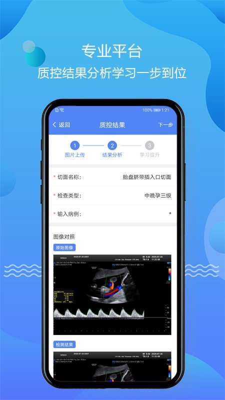 超声智库官方app截图2
