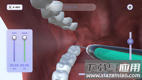 牙医模拟器游戏下载最新版截图2