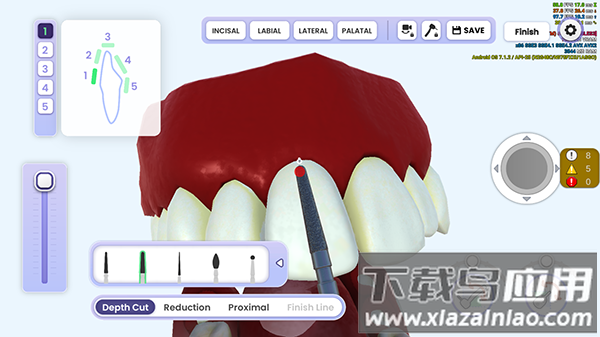 牙医模拟器游戏下载最新版截图4