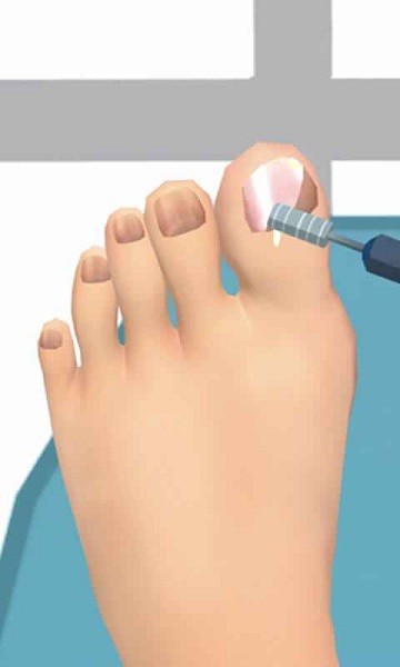 老板修个脚甲沟炎游戏最新版截图1