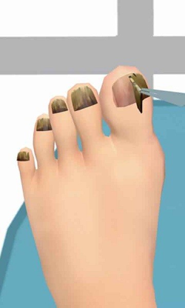 老板修个脚甲沟炎游戏最新版截图3