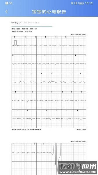 卡帕奇心电官方版截图
