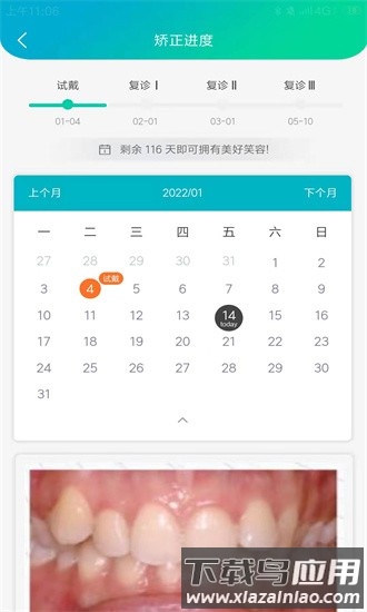 青椒美牙官方版最新版截图4