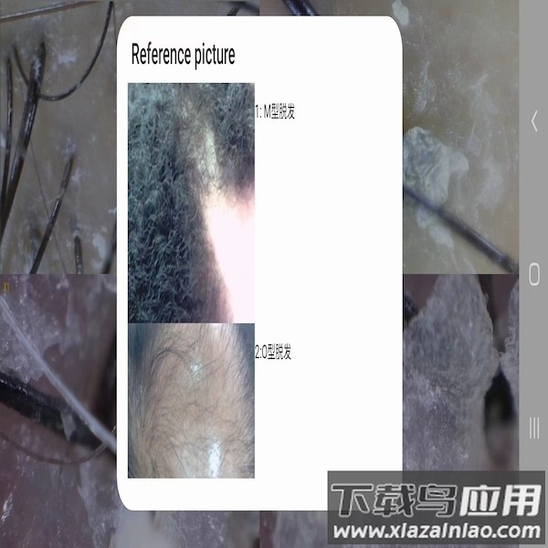 mrkv头皮检测app下载