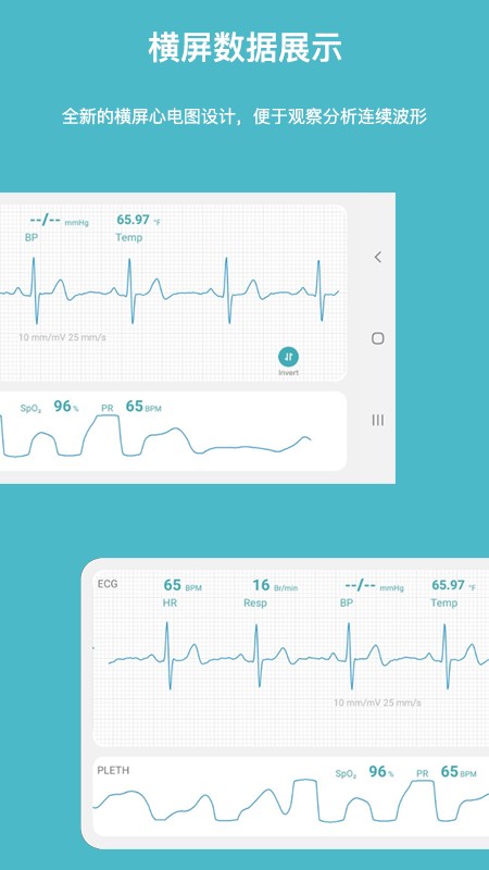 多体征监护仪下载