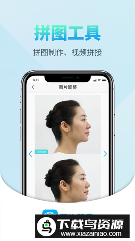 医拍即合最新版(前术后拍照对比档案相机)最新版截图3