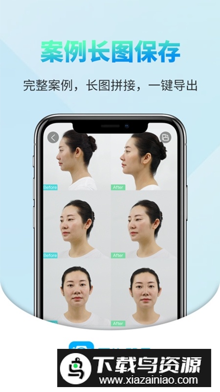 医拍即合最新版(前术后拍照对比档案相机)最新版截图4