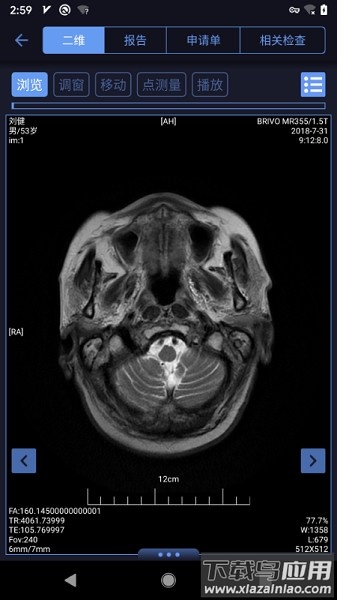 东软睿影app最新版截图2