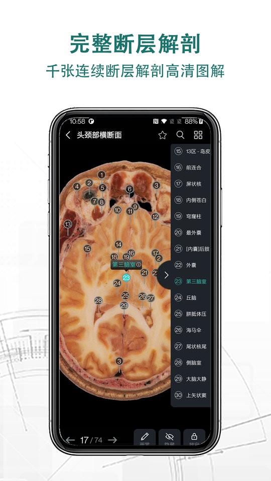 掌上3D解剖专业版最新版截图2