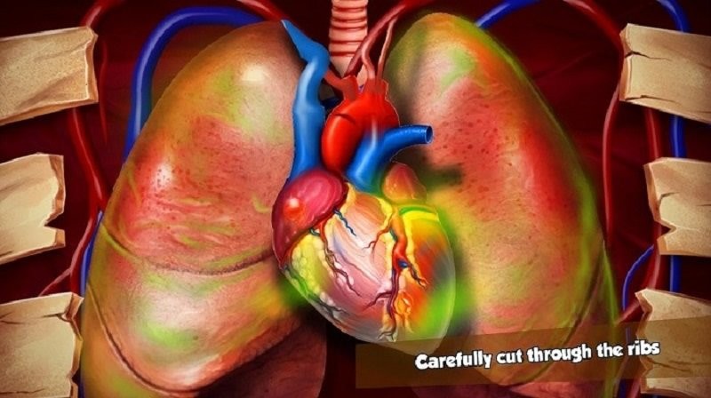 心脏手术模拟器(heart surgery)截图2