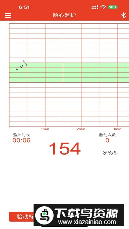左点胎心仪软件2025最新版截图5