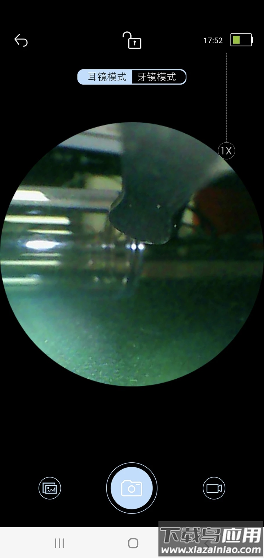 艾简美可视掏耳勺下载最新版截图2