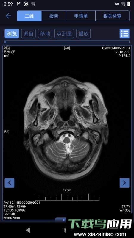 东软睿影报告查询截图1