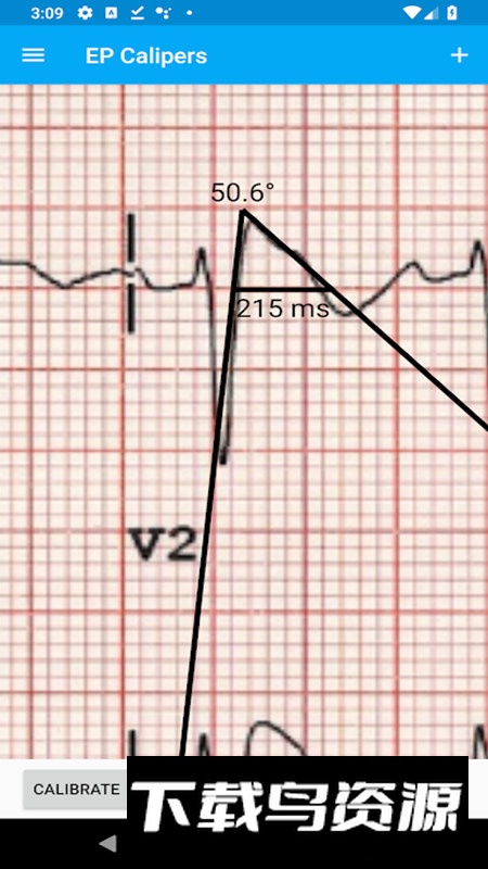 EP Mobile心率尺app安卓版最新版截图4