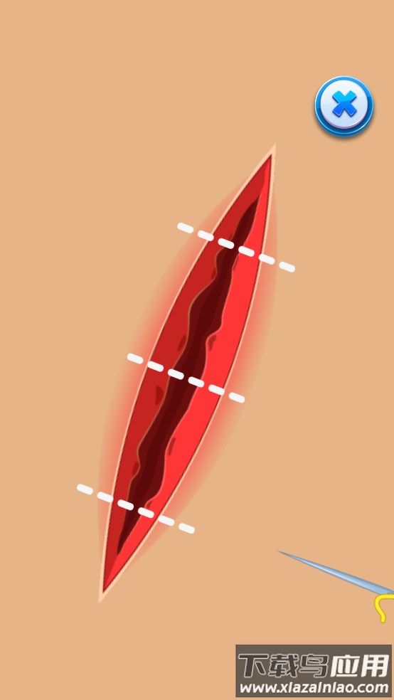 足部医生游戏(Foot Doctor)最新版截图1