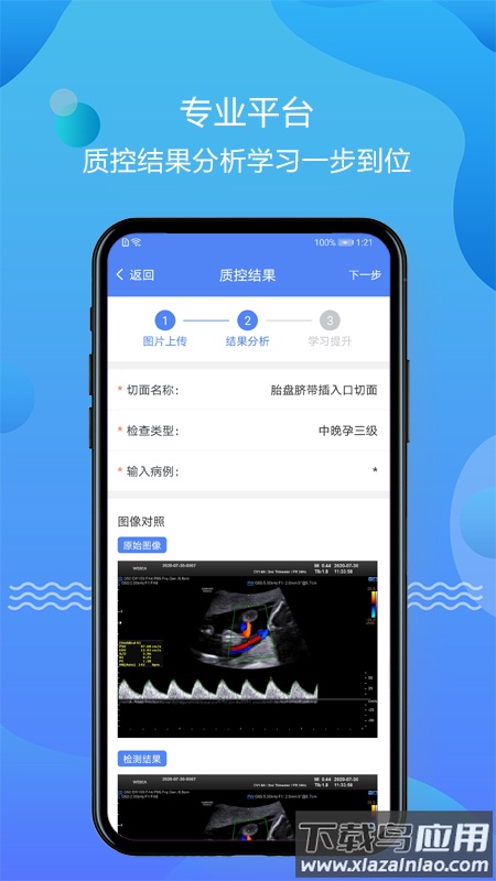 超声智库APP