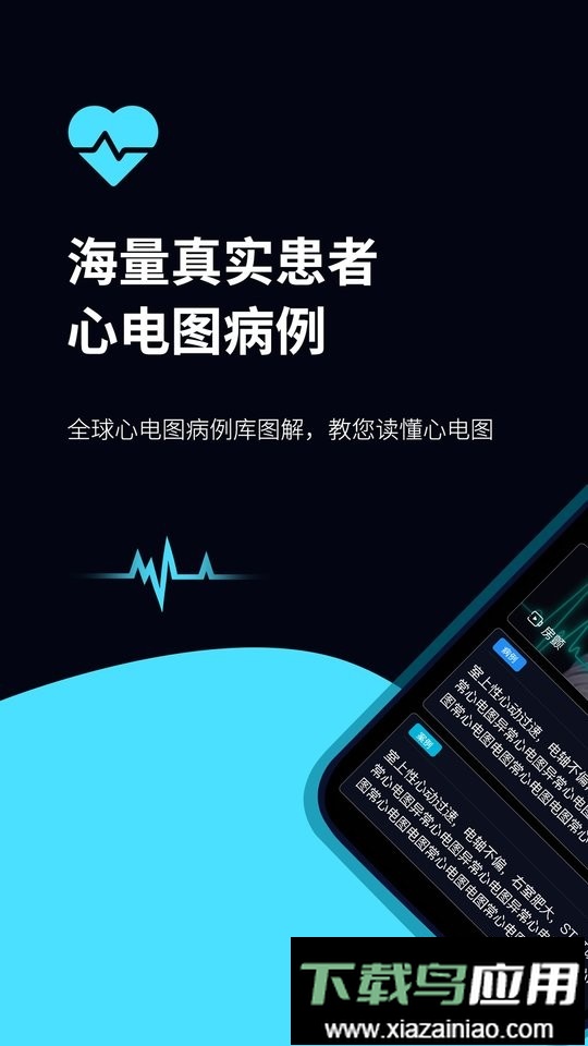 心电图ECG手机版最新版截图1