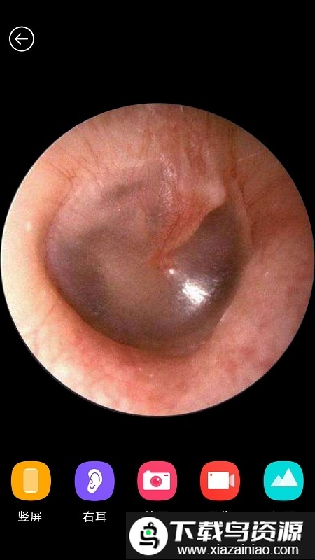 蜂鸟采耳棒app(bebird)最新版截图1