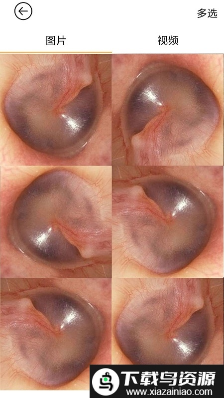 蜂鸟采耳棒app(bebird)最新版截图2