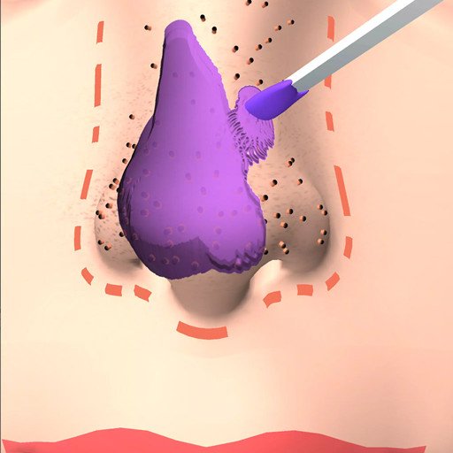 挤黑头大师官方版