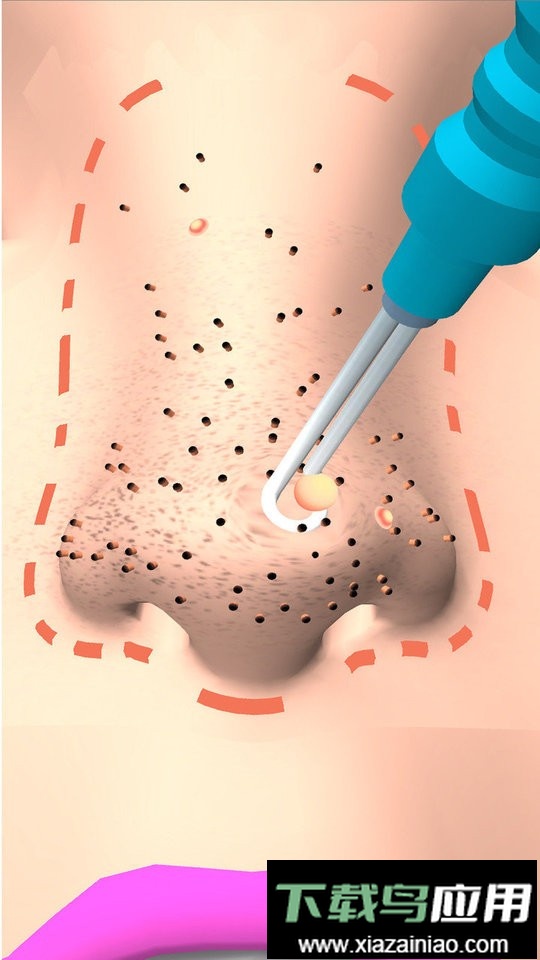 挤黑头大师官方版最新版截图1