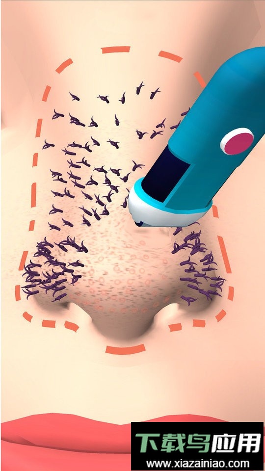 挤黑头大师官方版最新版截图3