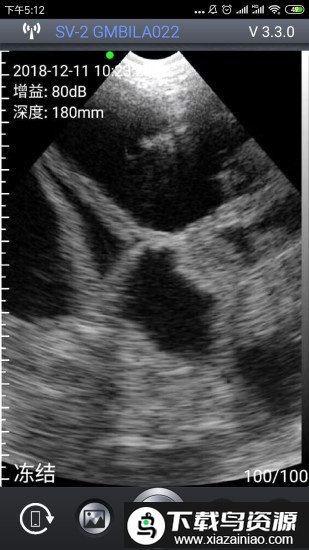 智能B超app手机版截图1