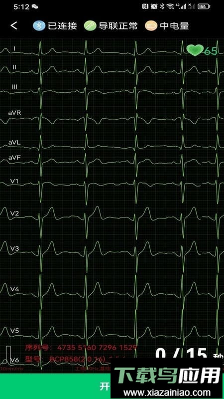 心电一张网官方版截图3