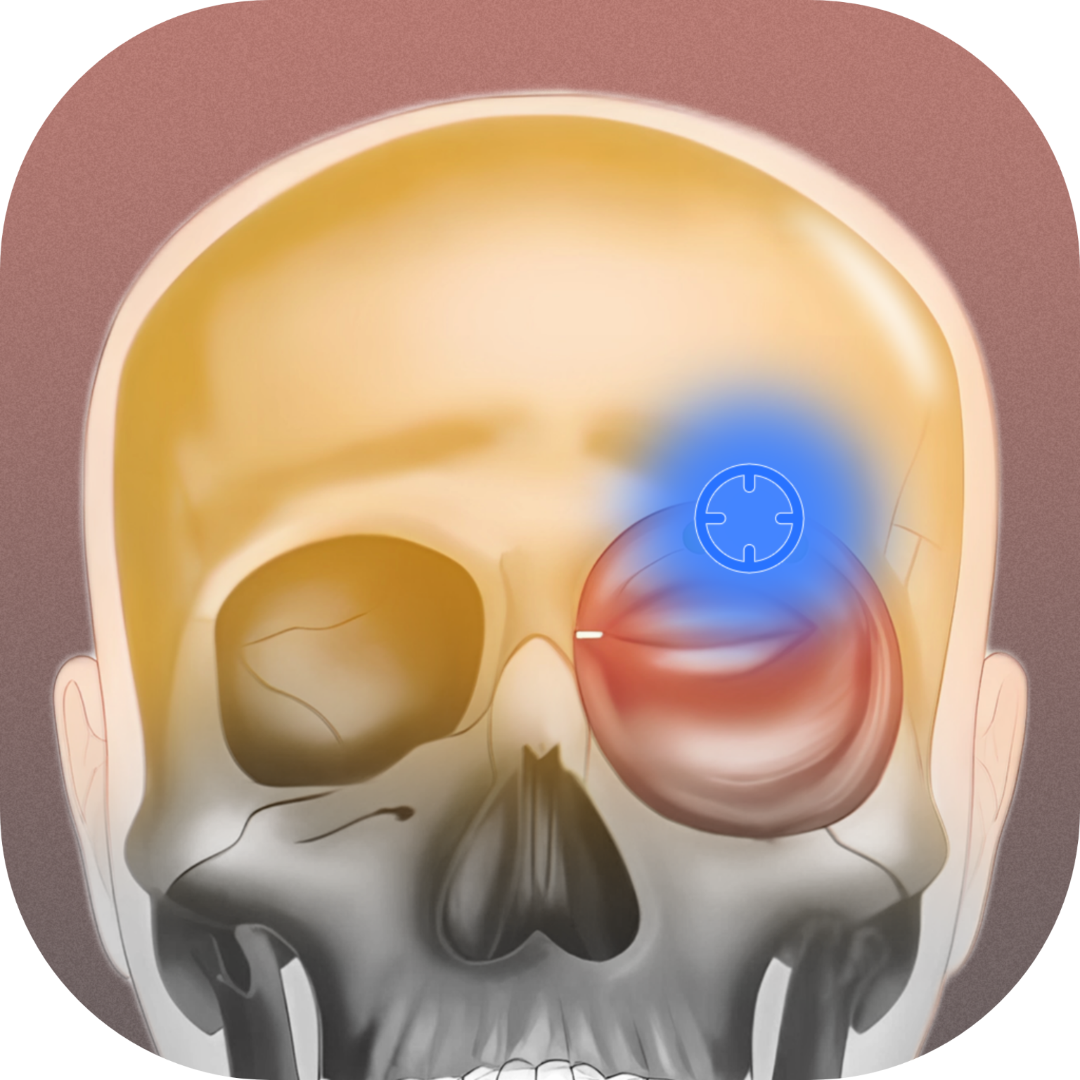 肌肉激痛点图谱软件下载